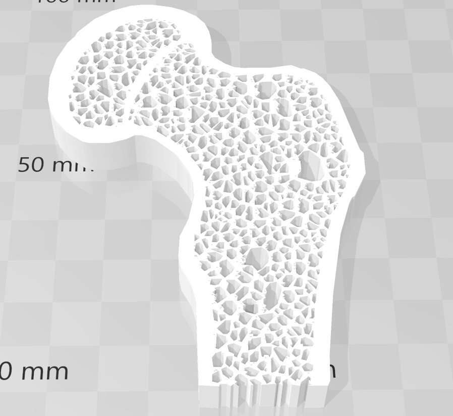 Cross-Section of Bone