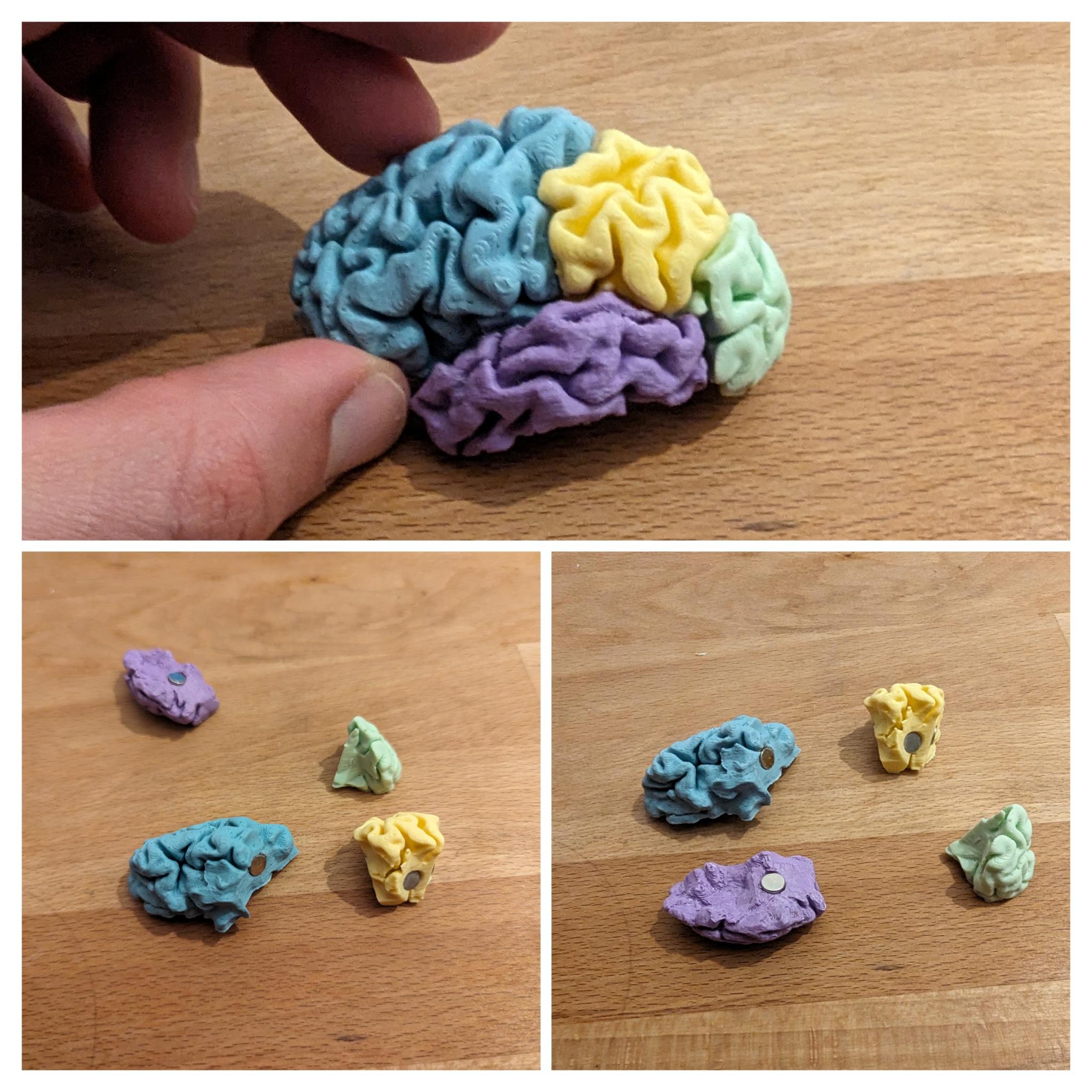 Brain in Parts