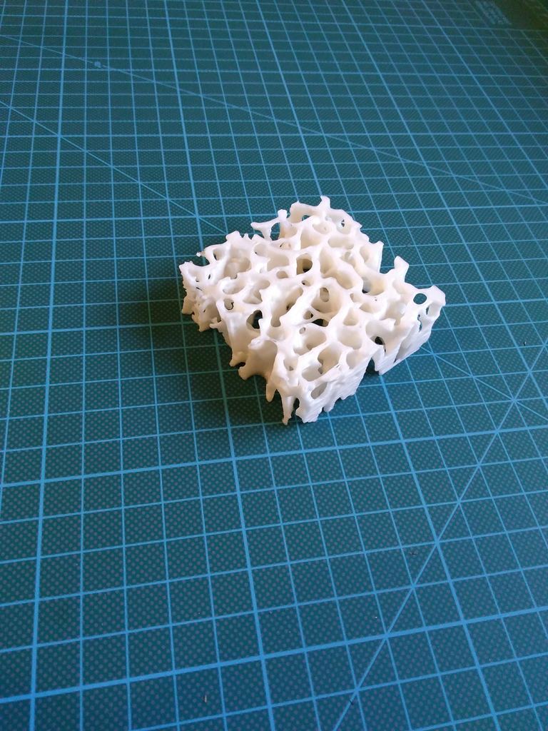 Trabecular Bone